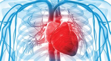 Differenze Tra Infarto E Arresto Cardiaco