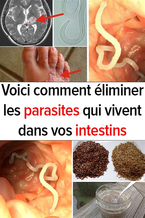 Voici comment éliminer les parasites qui vivent dans vos intestins