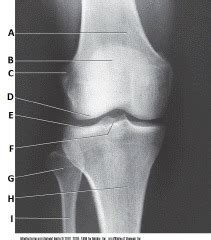 Ap Knee Label Diagram Quizlet