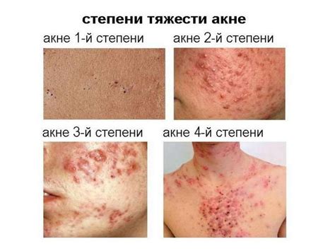 Болезни кожи - презентация онлайн