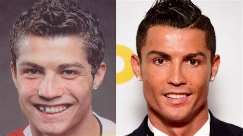 Cristiano Ronaldo Chirurgie Esth Tique L Incroyable Transformation