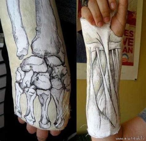 Pin By Gloria E On Curiosidades Manualidades Cast Art Arm Cast It Cast