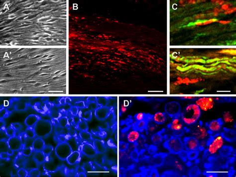 Supplementation Of Acellular Nerve Grafts With Skin Derived Precursor