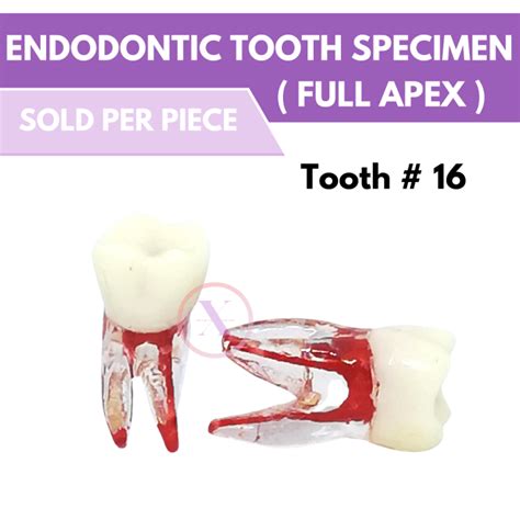 Endodontic Tooth Model Full Apex Tooth16 Xyz Merchandise Dental