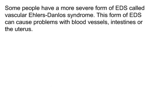 Ehlers Danlos Syndrome