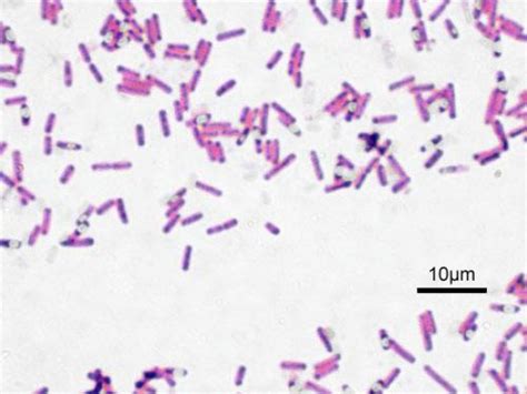 Difference Between Cocci and Bacilli | Characteristics, Structure, Examples