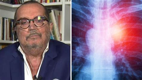 Franco Di Mare morto per mesotelioma la malattia cos è chi colpisce