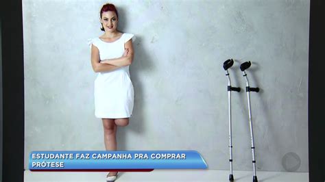 Jovem Que Teve Perna Amputada Em Acidente Faz Campanha Pra Comprar