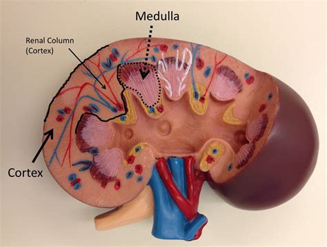 Renal Ultrasound - Cortical Nephrocalcinosis — @swissnephro