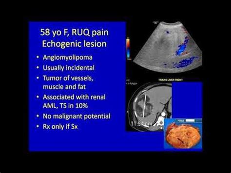 Liver Lesions Medizzy