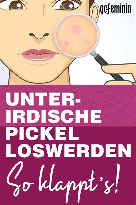 Unterirdische Pickel Woher Sie Kommen Und Was WIRKLICH Dagegen Hilft