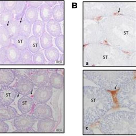 Staining Of Caspase And Bcl Immunoreactivity In Rat Testicular