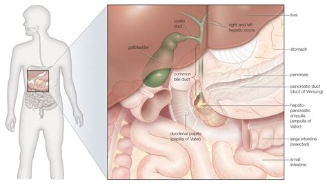 Acute Cholangitis Symptoms And Treatment