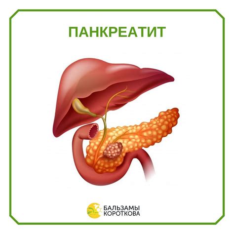 Панкреатит