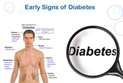 Type 2 Diabetes Symptoms And Signs Health Normal