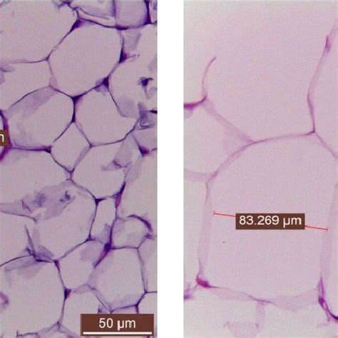 Histology Of The Epididymal White Adipose Tissue WAT Of Mice In The