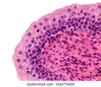 Mucosa Urinary Bladder Lined By Transitional Stock Photo