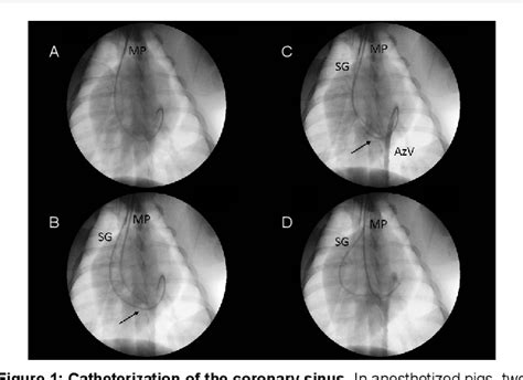 Figure 1 From Human Interleukin 10 Naked DNA Delivery To Infarcted Pig