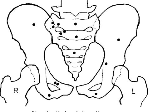 Figure 9 From Giant Cell Tumors Semantic Scholar