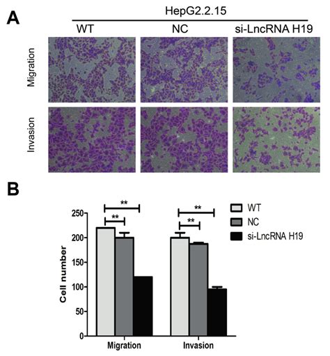 Knockdown Of LncRNA H19 Inhibited Cell Migration And Invasion A B