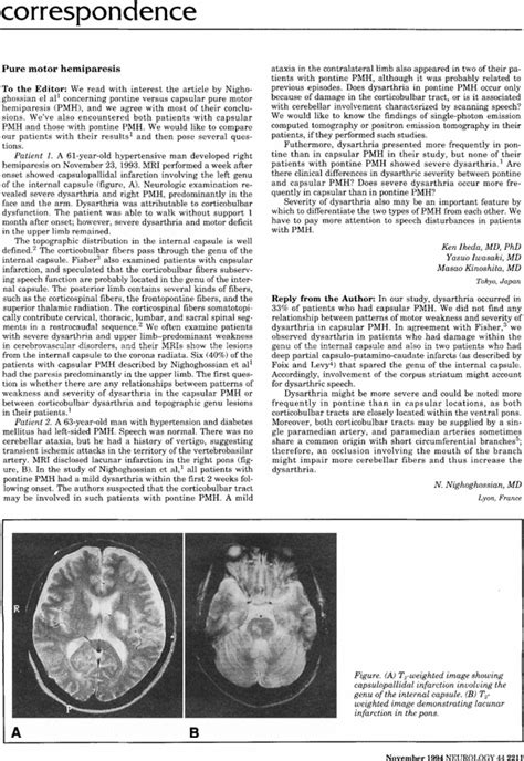 Treatment Of Cerebrotendinous Xanthomatosis Neurology