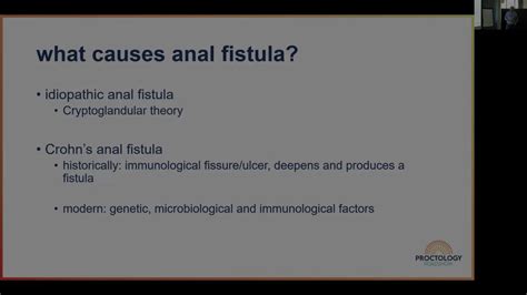 Anal Fistula Peianal Crohn S And Rectovaginal Fistula Content MedAll