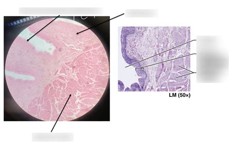 Bsc Anatomy Lab Exam Bladder Histology Diagram Quizlet