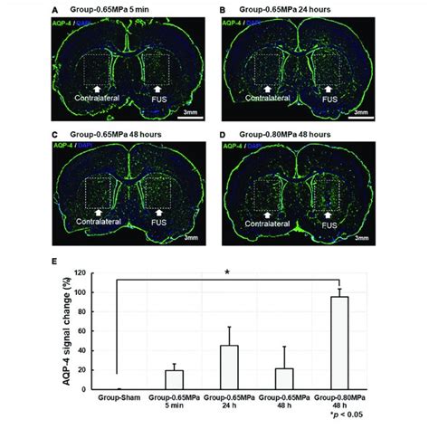 Representative Aqp 4 Immunostaining At Caudate Putamen For Group 065 Download Scientific