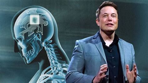 Neuralink De Elon Musk Recibe El Permiso De La Fda Para Comenzar A