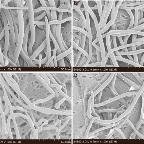 Hyphal Morphology Of R Solani Isolate Lk4 Grown On Pda Amended With