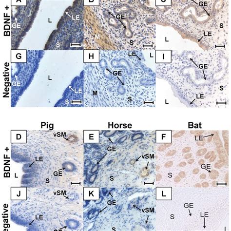 Immunohistochemical Localization Of Bdnf In The Uterus Uterine