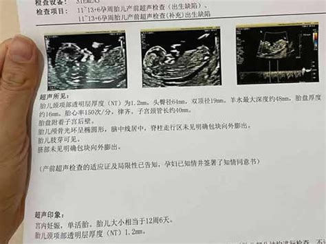 13周nt男孩图 千图网