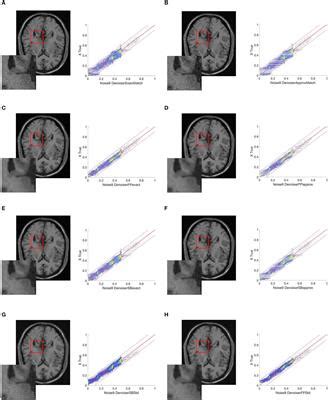 Frontiers Magnetic Resonance Imaging Enhancement Using Prior