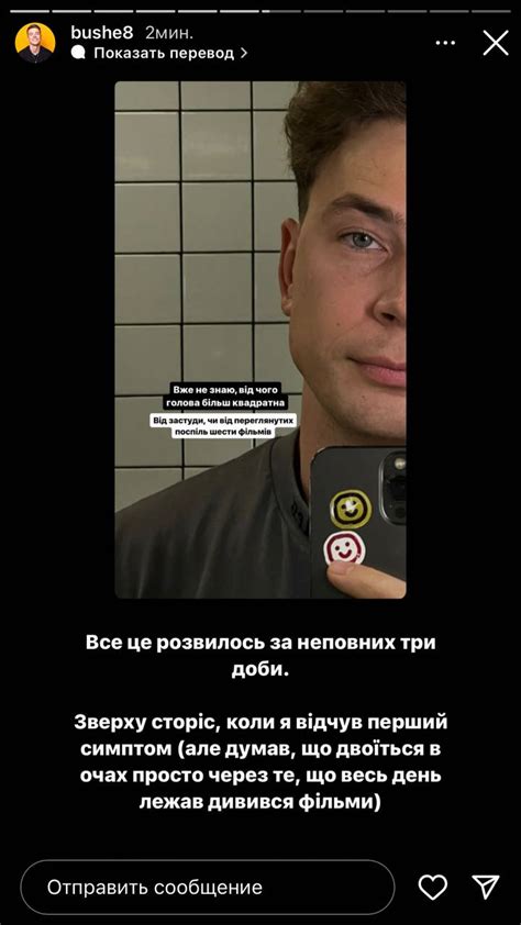 Богдан Буше Шелудяк сделал заявление о своей болезни | РБК Украина