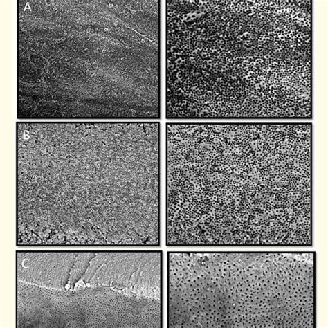 Sem Micrographs Showing Smear Layer Removal In Samples Of Group I