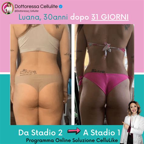 Prima E Dopo Dottoressa Cellulite