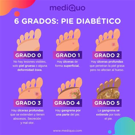 Grado Del Pie Diab Tico Cuidados De Pie Diabetico Pie Diabetico Pie