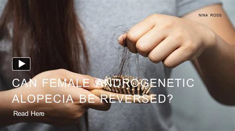 Ppt Can Female Androgenetic Alopecia Be Reversed Insights And