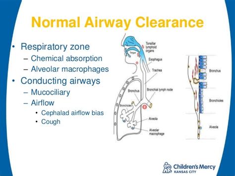 Assisted Airway Clearance In Pediatric Respiratory Disease