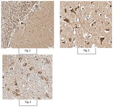 Anti Bst Antibody From Rabbit Purified By Affinity Chromatography