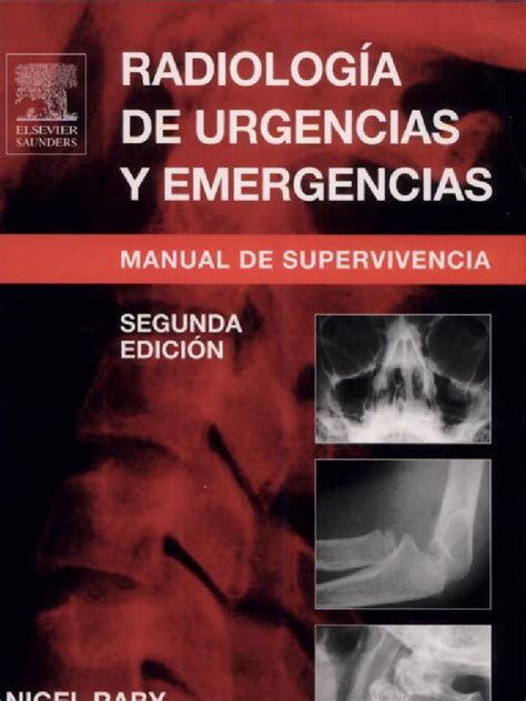 PDF Radiolog A De Urgencias Y Emergencias DOKUMEN TIPS