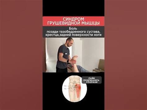 Синдром грушевидной мышцы как убрать? Освобождение седалищного нерва ...
