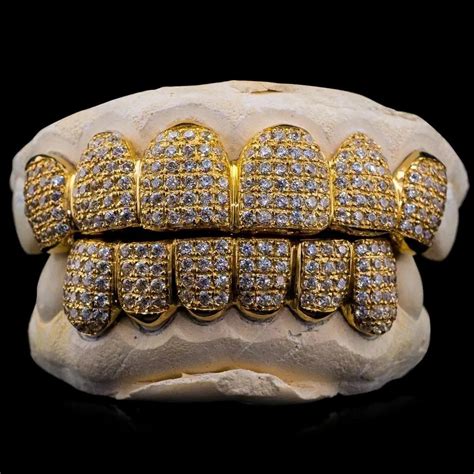 Real Diamonds Round Diamond Teeth Grillz Weight Custom At ₹ 49999