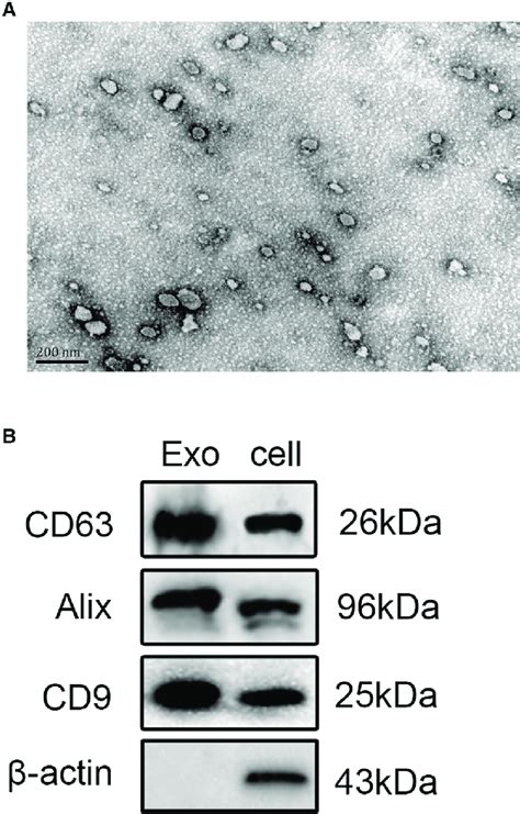 Characterization Of Microglia Derived Exosomes A Transmission