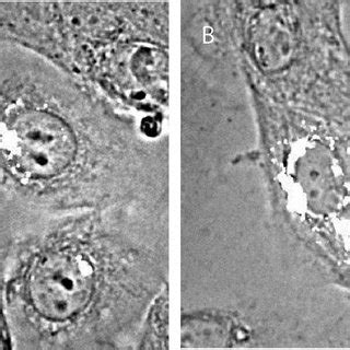 Double Immunofluorescence Staining Shows That Type Xvii Collagen