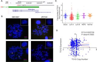 Genetic and Epigenetic Regulation of TOX3 Expression in Breast Cancer