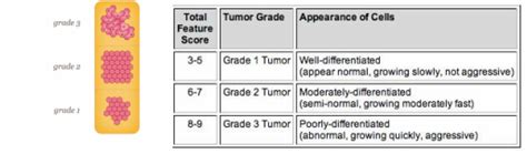 Staging And Grading Breast Cancer