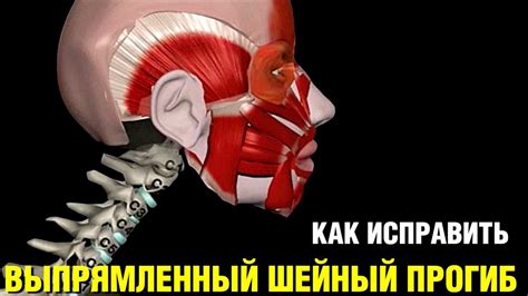 Шейный прогиб выпрямлен. Сглажен лордоз. Уплощение шейного отдела ...