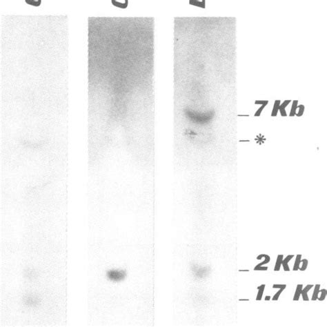 Southern Blot Analysis Of Total Genomic Dna Digested With Ecorl And