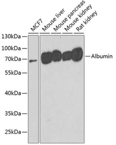 Albumin Polyclonal Antibody Invitrogen L Unconjugated Fisher